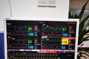 漫漫长夜搬家减重技巧？如何有效减轻搬家负担？